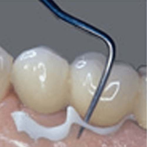 implantlink semi