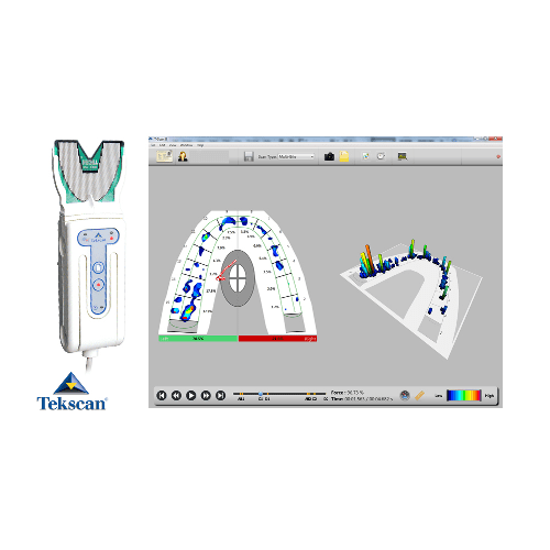 T-Scan® System