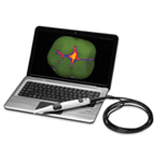 Spectra Caries Detection Aid