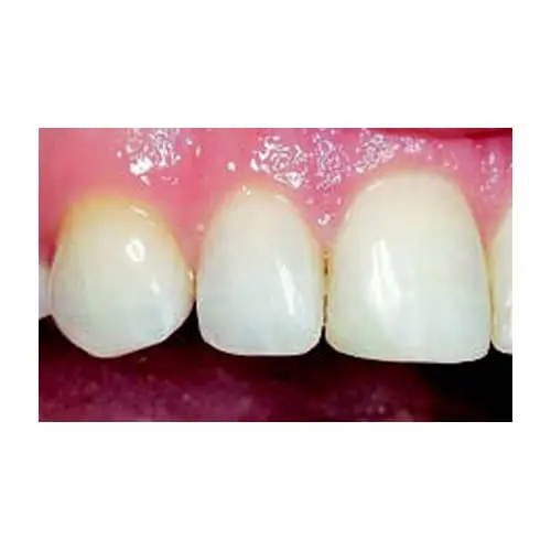 G-aenial Bond (4 yr)