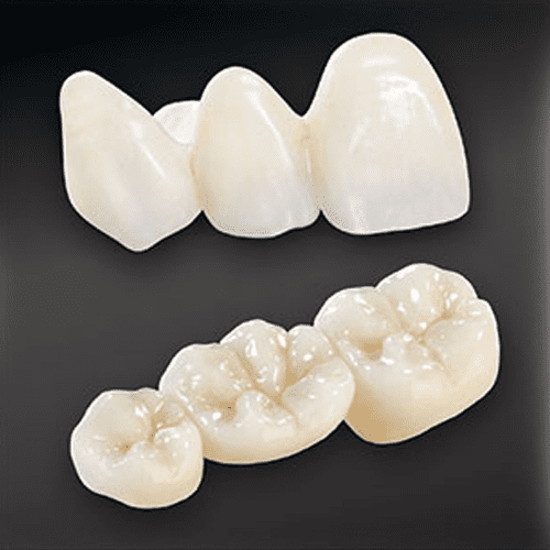 BruxZir Anterior