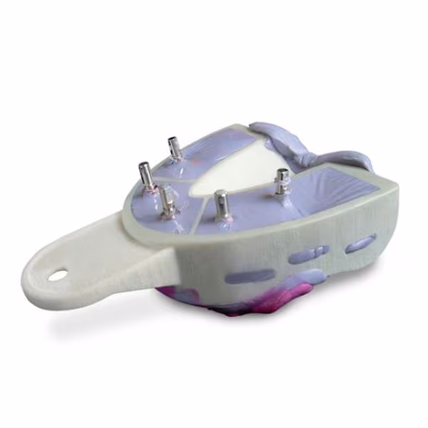 MiraTray Implant Advanced