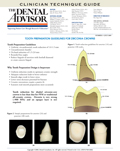 Tooth Preparation Guidelines for Zirconia Crowns